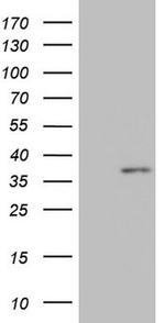 MED6 Antibody in Western Blot (WB)