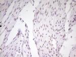 MEF2D Antibody in Immunohistochemistry (Paraffin) (IHC (P))