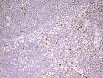 MEF2D Antibody in Immunohistochemistry (Paraffin) (IHC (P))