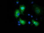 MGRN1 Antibody in Immunocytochemistry (ICC/IF)