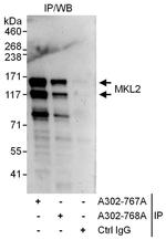 MKL2 Antibody in Immunoprecipitation (IP)