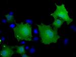 MOBKL2B Antibody in Immunocytochemistry (ICC/IF)
