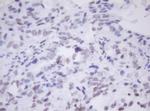 MORF4 Antibody in Immunohistochemistry (Paraffin) (IHC (P))
