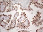 MRPL10 Antibody in Immunohistochemistry (Paraffin) (IHC (P))