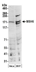 MSH6 Antibody in Western Blot (WB)