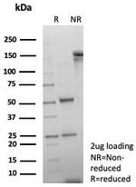 Double Stranded DNA (dsDNA) (Nuclear Marker) Antibody in Immunohistochemistry (Paraffin) (IHC (P))