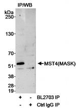 MST4/MASK Antibody in Immunoprecipitation (IP)