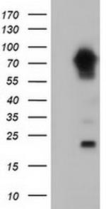 MTMR14 Antibody in Western Blot (WB)