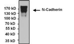 N-cadherin Antibody in Immunoprecipitation (IP)