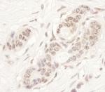 NAT10 Antibody in Immunohistochemistry (IHC)