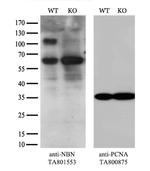 NBN Antibody in Western Blot (WB)