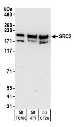 NCOA2/SRC2 Antibody in Western Blot (WB)