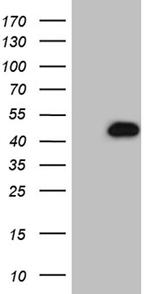 NDUFAF5 Antibody in Western Blot (WB)