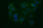 NEFM Antibody in Immunocytochemistry (ICC/IF)