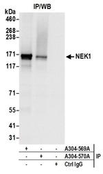 NEK1 Antibody in Immunoprecipitation (IP)