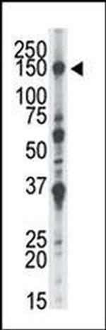NEK1 Antibody in Western Blot (WB)