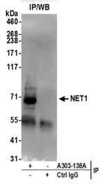 NET1 Antibody in Western Blot (WB)