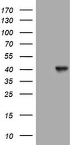 NEU1 Antibody in Western Blot (WB)