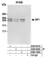 NF1 Antibody in Immunoprecipitation (IP)