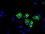 NIT1 Antibody in Immunocytochemistry (ICC/IF)