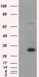NIT1 Antibody in Western Blot (WB)