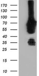 NMT2 Antibody in Western Blot (WB)