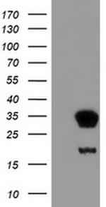 NNMT Antibody in Western Blot (WB)