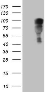 NR3C1 Antibody in Western Blot (WB)