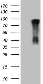 NR3C1 Antibody in Western Blot (WB)