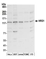NRD1/Nardilysin Antibody in Western Blot (WB)