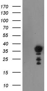 NRIP3 Antibody in Western Blot (WB)