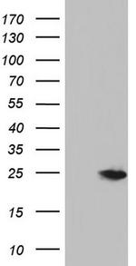 NUDT10 Antibody in Western Blot (WB)