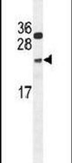 NUDT15 Antibody in Western Blot (WB)