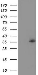 NUDT6 Antibody in Western Blot (WB)