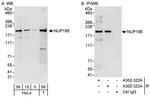 NUP188 Antibody in Western Blot (WB)