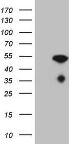 NUP43 Antibody in Western Blot (WB)