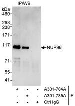 NUP96 Antibody in Immunoprecipitation (IP)