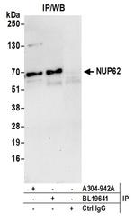 Nucleoporin p62/NUP62 Antibody in Western Blot (WB)