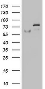 OAS2 Antibody in Western Blot (WB)