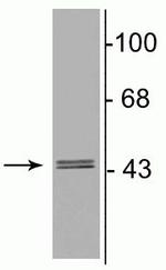 GABRG2 Antibody in Western Blot (WB)