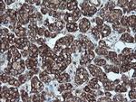 CDKN2A (p16INK4a) Antibody in Immunohistochemistry (Paraffin) (IHC (P))