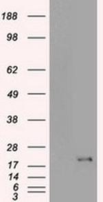 CDKN2A (p16INK4a) Antibody in Western Blot (WB)