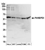 P4HB/PDI Antibody in Western Blot (WB)