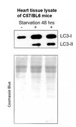 LC3A/LC3B Antibody in Western Blot (WB)