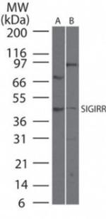 SIGIRR Antibody in Western Blot (WB)