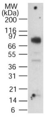 CGBP Antibody in Western Blot (WB)