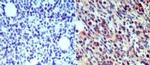 Langerin Antibody in Immunohistochemistry (Paraffin) (IHC (P))