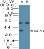 VDAC2/VDAC3 Antibody in Western Blot (WB)