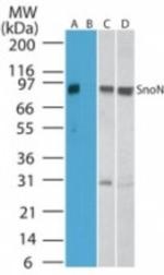 SnoN Antibody in Western Blot (WB)
