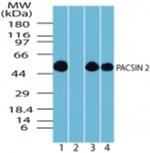 PACSIN2 Antibody in Western Blot (WB)